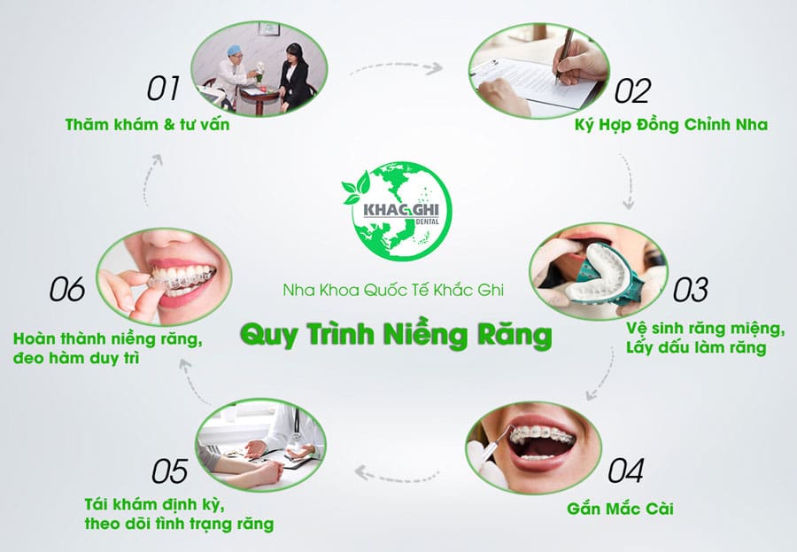 6 bước niềng răng chỉnh nha chuẩn quốc tế tại nha khoa khắcghi