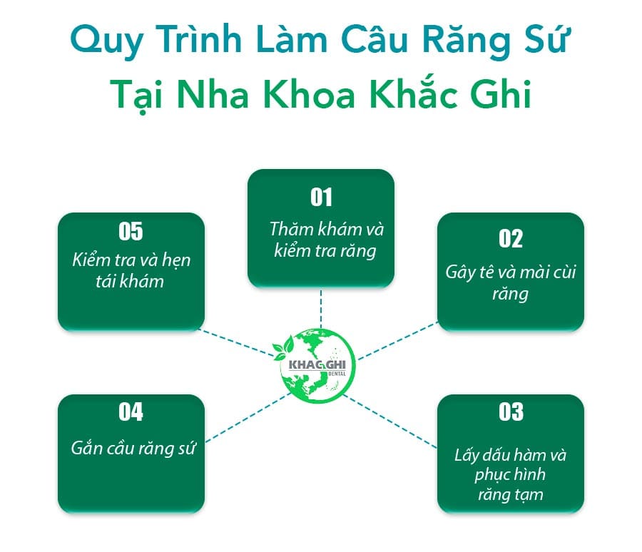 Quy Trình Làm Cầu Răng Sứ Chi Tiết Qua 5 Bước Chuẩn Y Khoa 10 quy trình làm cầu răng sứ tại nha khoa khắc ghi