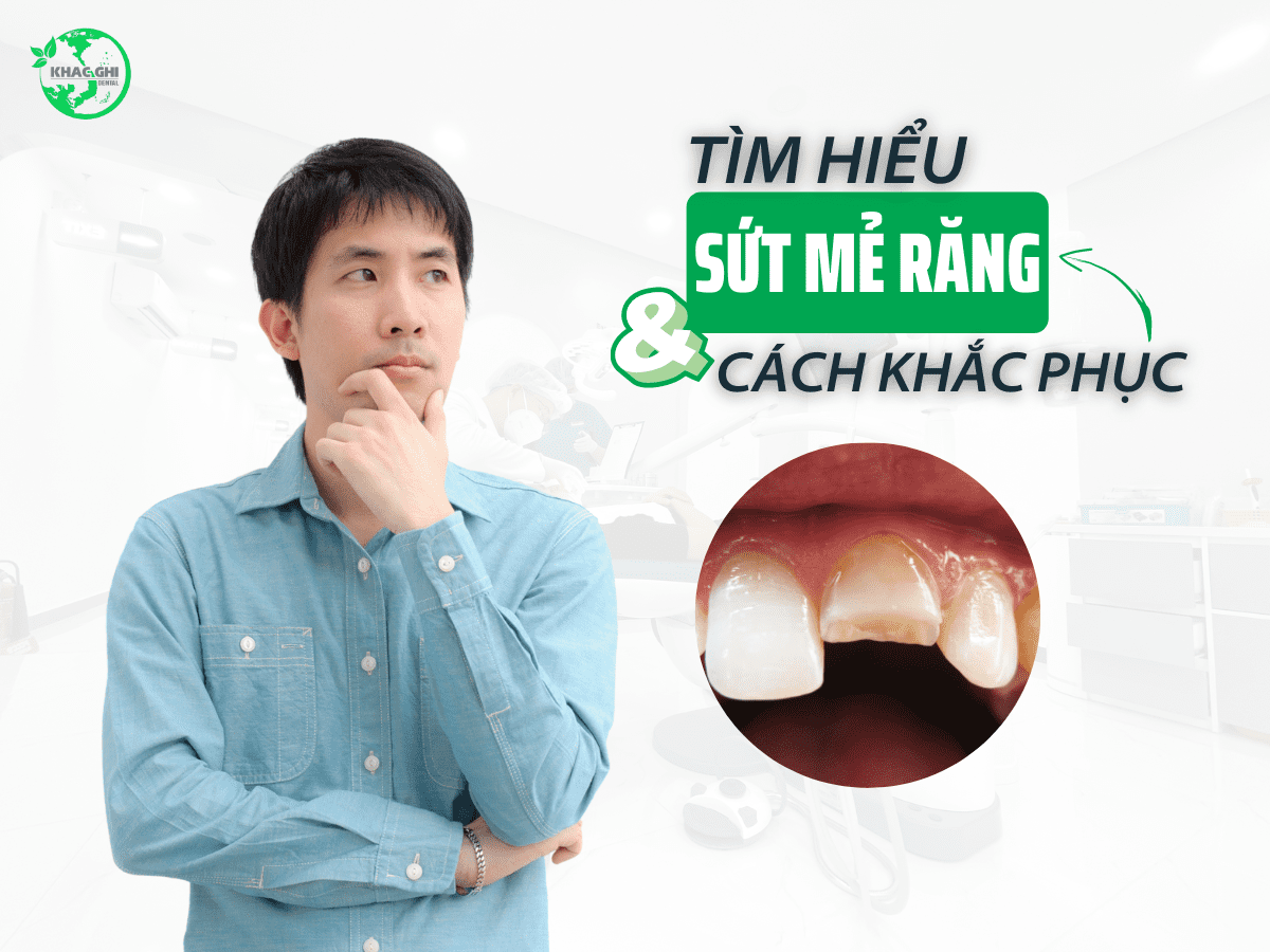 sut me rang la gi cach khac phuc sut me rang hieu qua 1