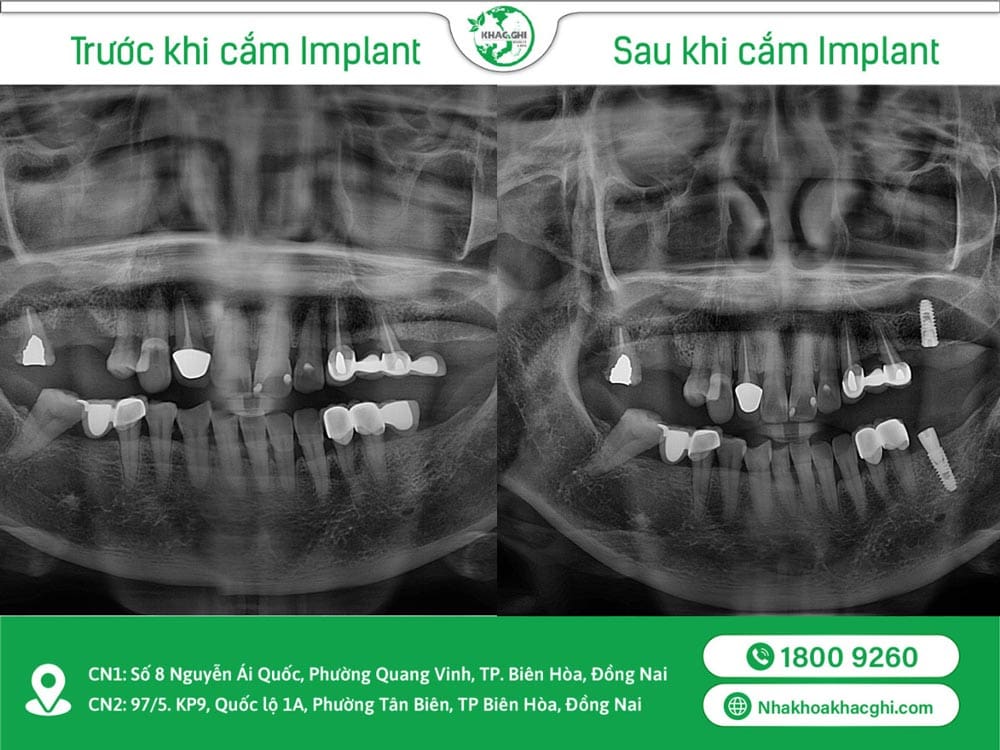 tri an khach hang nhan ngan qua tang tu khac ghi 16