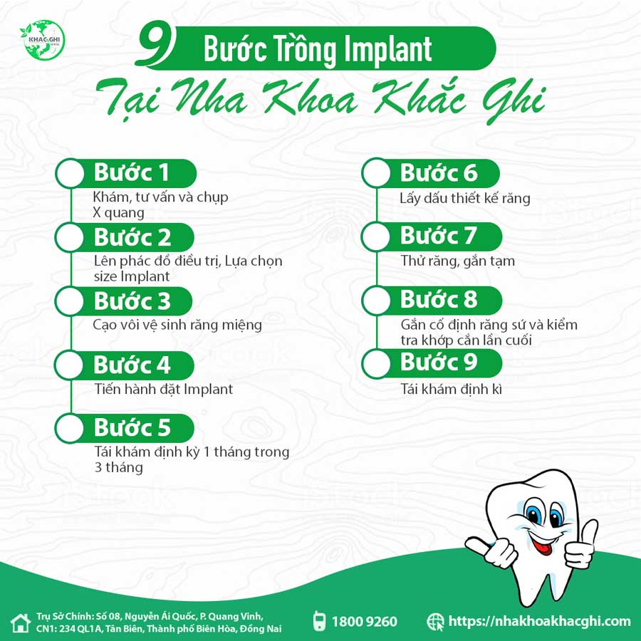 9 bước trồng răng implant chuẩn quốc tế tại nha khoa khắc ghi