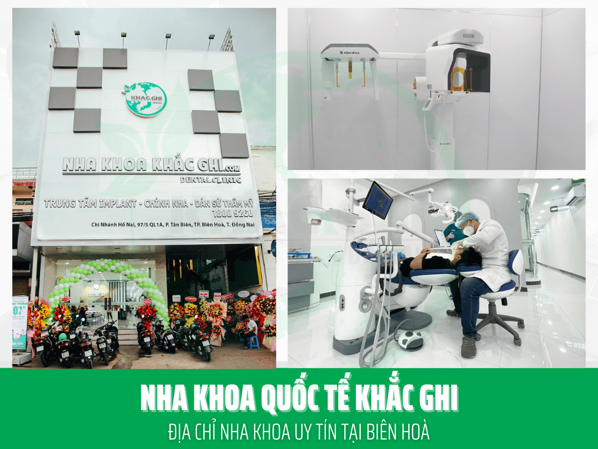 Nha Khoa Quốc Tế Khắc Ghi - Địa chỉ làm răng Biên Hòa uy tín