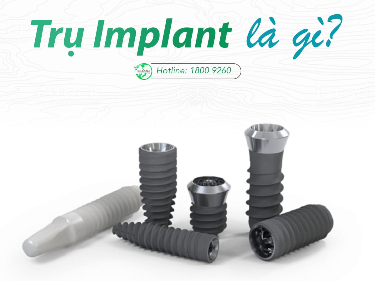 Trụ Implant là gì ?