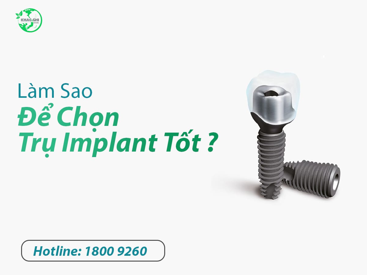 Làm sao để chọn trụ implant tốt